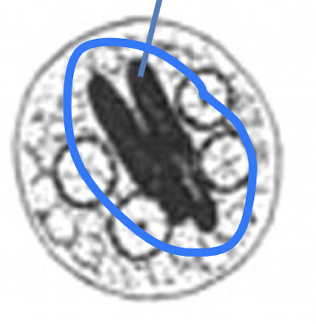 <p>what is this called?</p>