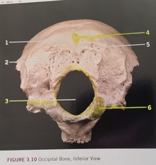 <p>disarticulated</p>