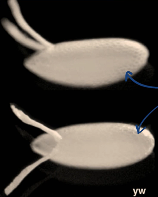 <p>The shell of the Drosophila egg</p><ul><li><p>Rigid, acts as a physical barrier to sperm</p></li></ul><p></p>