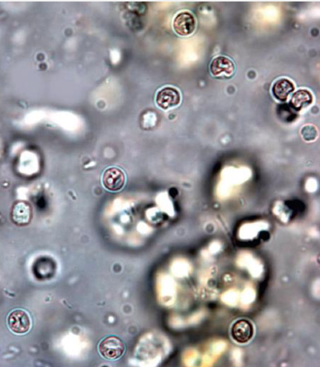 <p>Name this Apicomplexa</p>