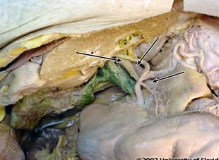 <p>what vein is being indicated to in the image?</p>