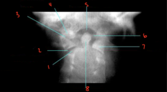 <p>What is labeled 3?</p>
