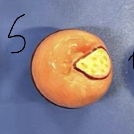 term image