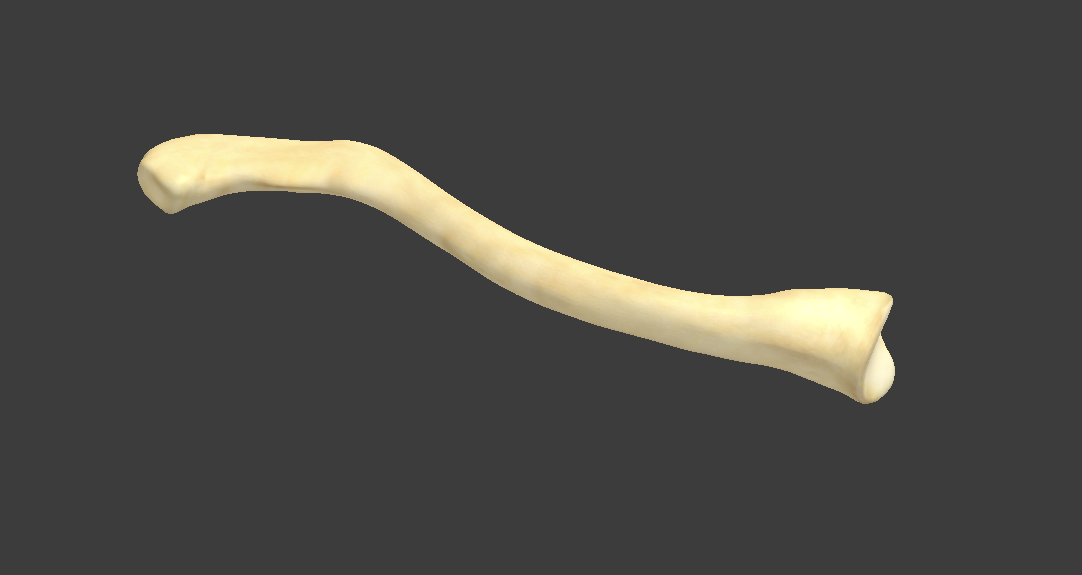 <p>What bone is this?</p>
