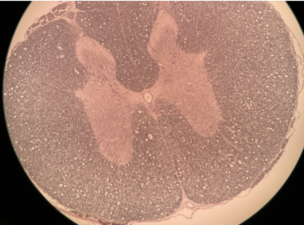 <p>Identify the region of the spinal cord this cross section is from.</p>