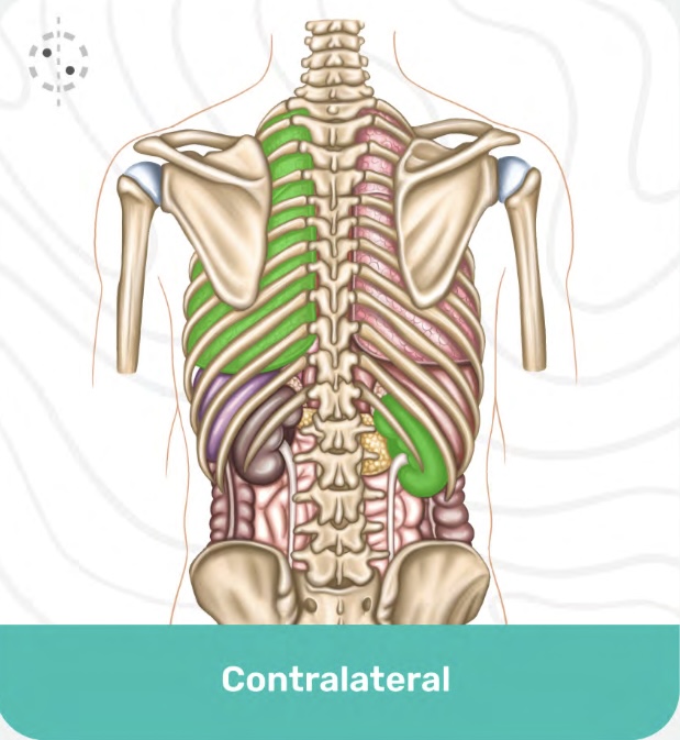 <p>Contralateral</p>