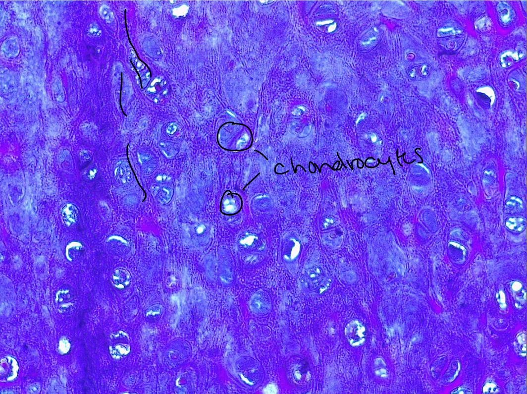 <p>Elastic cartilage. More elastic fibers than hyaline cartilage, giving it a stringy appearance. Gives structure with added flexibility for stretch and recoil, like in the pinna of the ear. </p>