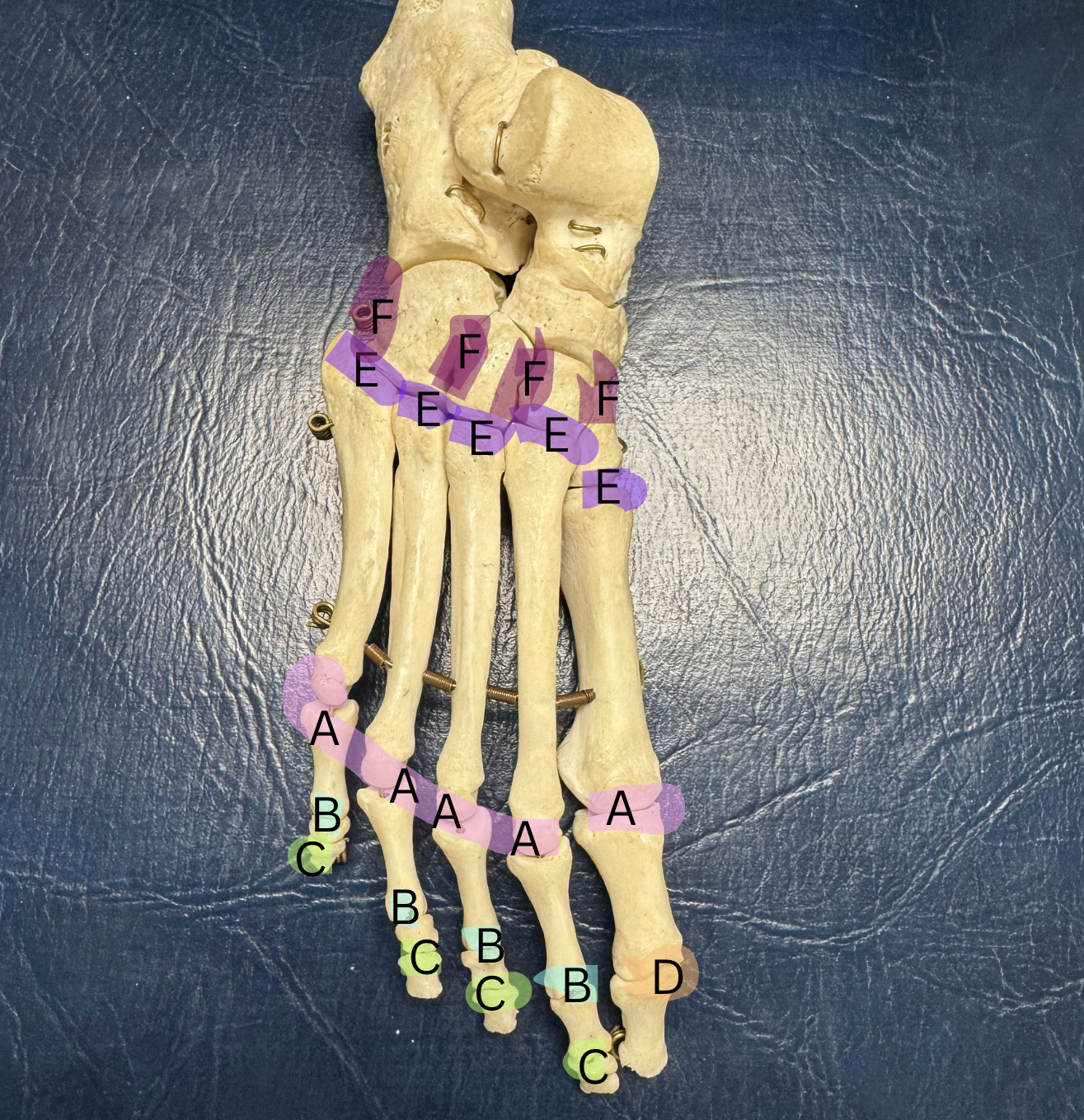 <p><span>Label these joints A-F</span></p>