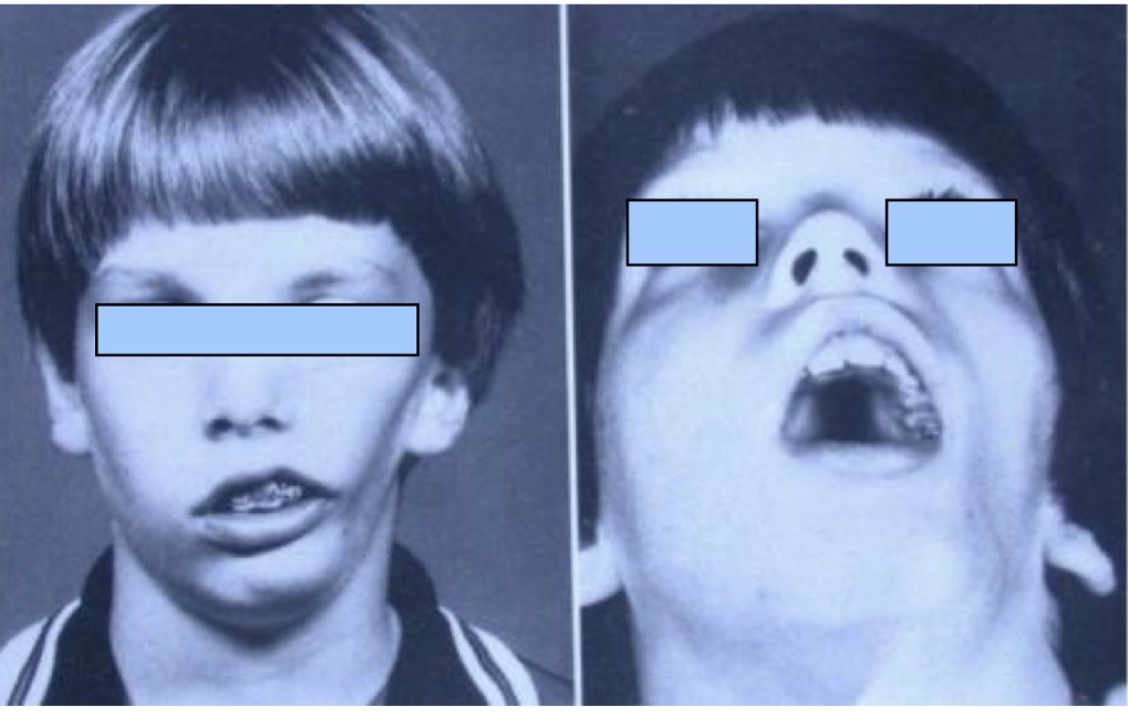 term image