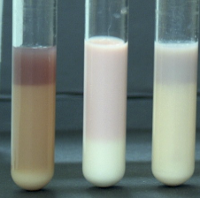 <p>Interpret the results for <strong>Litmus Milk Test</strong>.</p>
