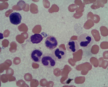 <p>» Cells become smaller in size with each division</p><p>» Nucleus becomes more elonogated -> band shaped (horseshoe or S)</p><p>• – Nucleus thinnest part is less than 1/3 the thickness of the thickest part</p><p>» Ultimately the cells mature to lobed polymorphonuclear cells (PMNs) or granulocytes</p>