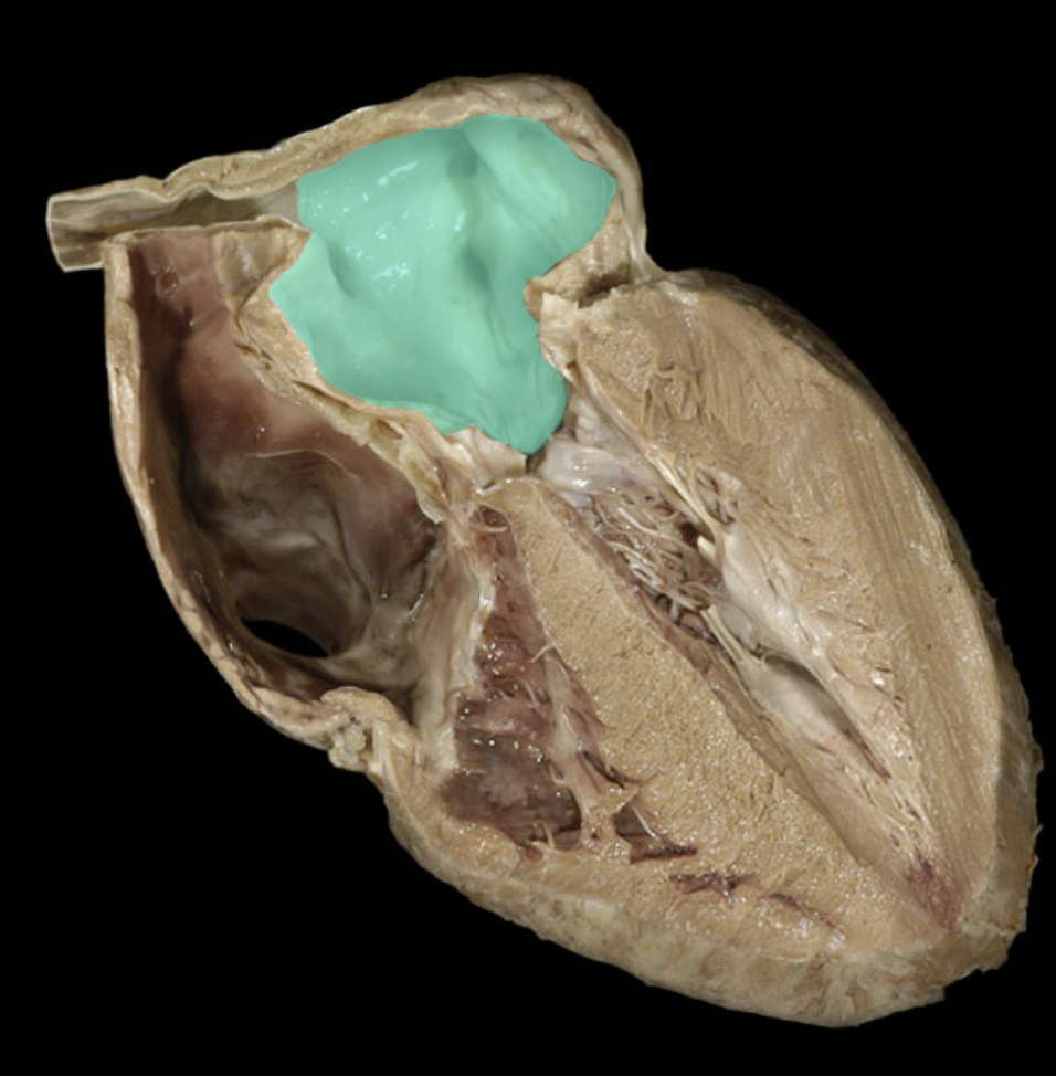 <p>Left atrium</p>