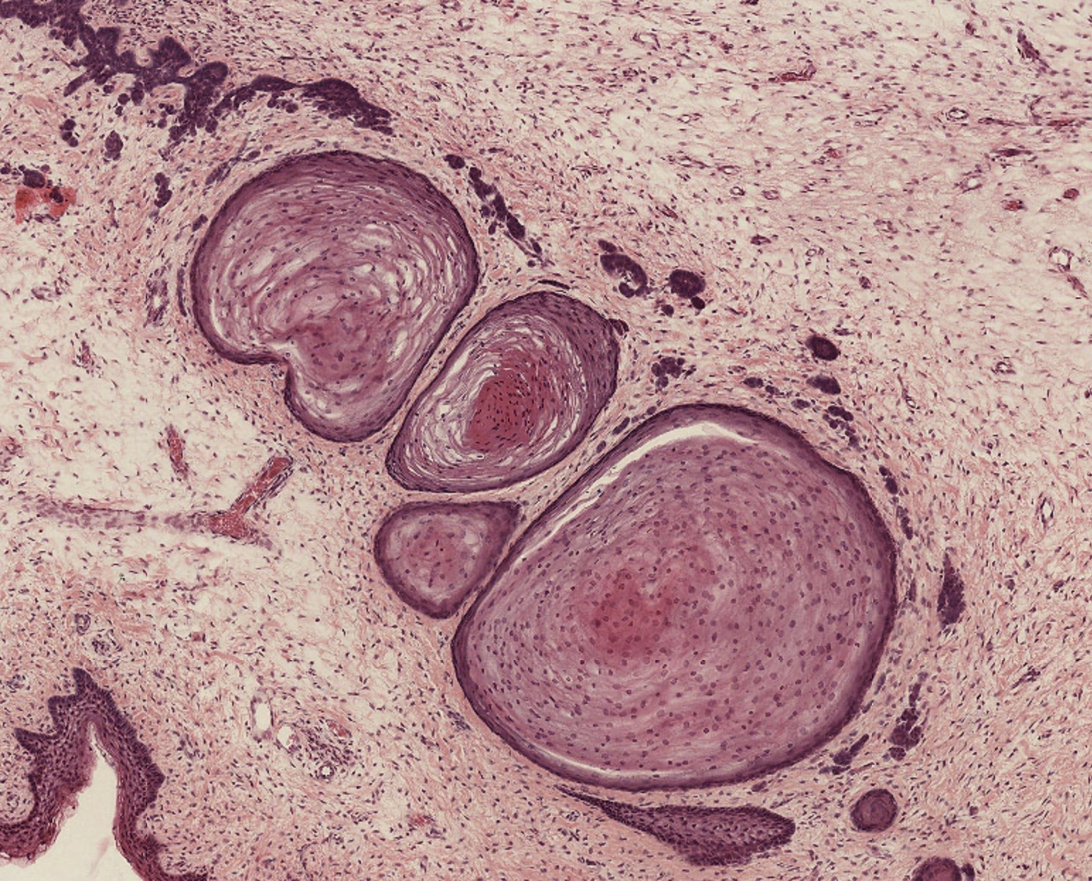 term image