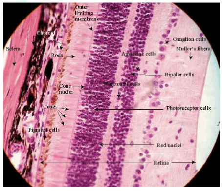 <p>- sclera</p><p>- choroid</p><p>- fovea (centralis)</p><p>- photoreceptors (rods and cones)</p>