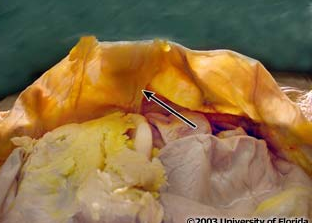 <p>what fold of the peritoneum located on the inner surface of the anterior abdominal wall is indictaed in the image?</p>