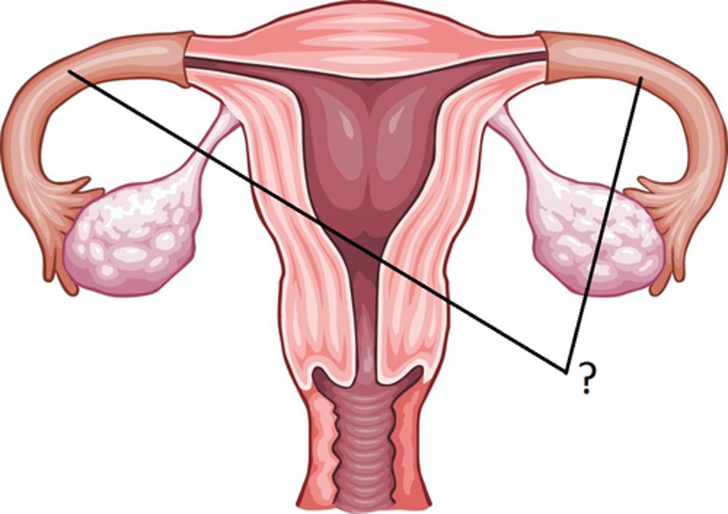 <p>tubes extending from each side of the uterus toward the ovary that provide a passage for ova to the uterus</p>