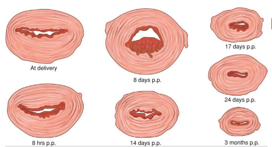 <ul><li><p>dilated, edematous, and bruised </p></li><li><p>small tears or lacerations may be present </p></li><li><p>rapid healing takes place</p></li></ul><p></p>