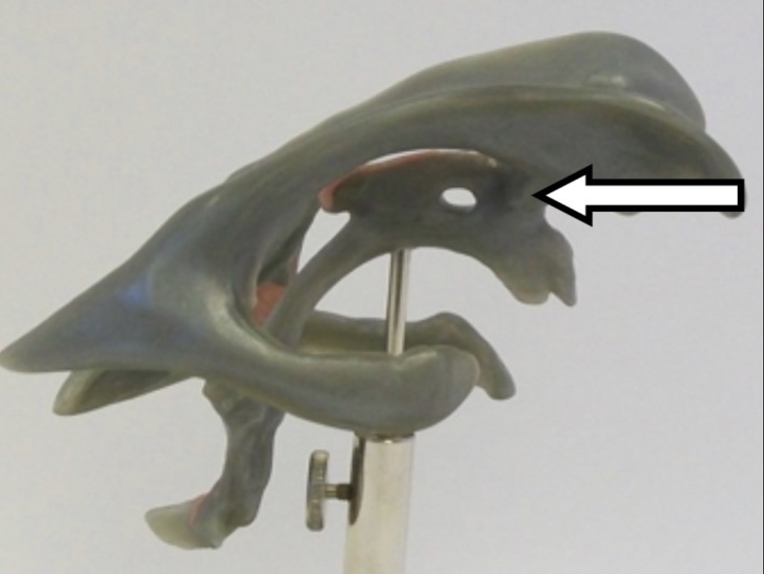 <p>What is the arrow pointing to?</p>