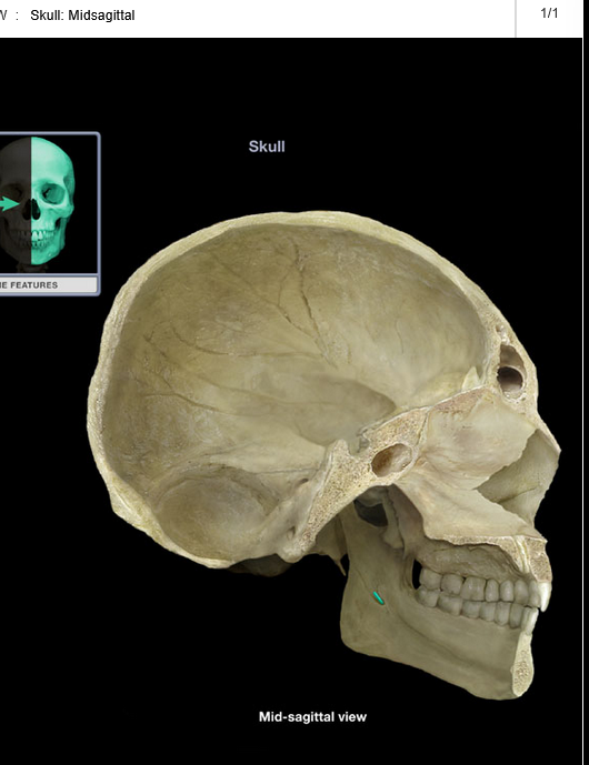 <p>Mandibular foramen</p>