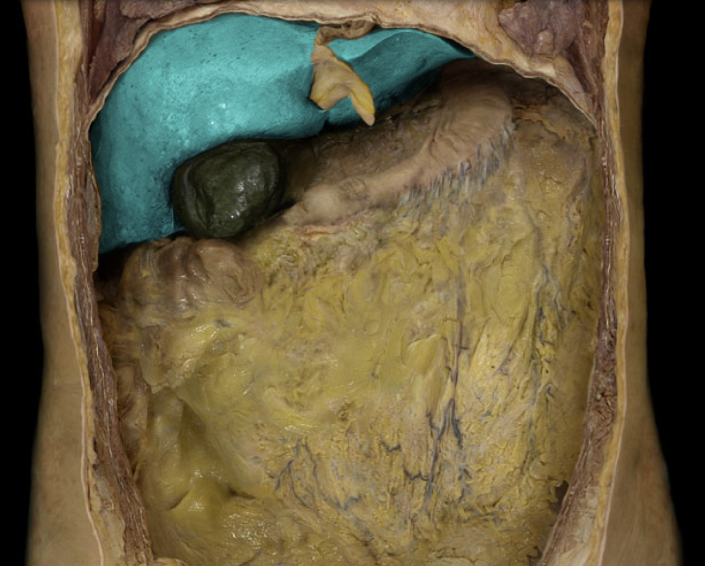 term image