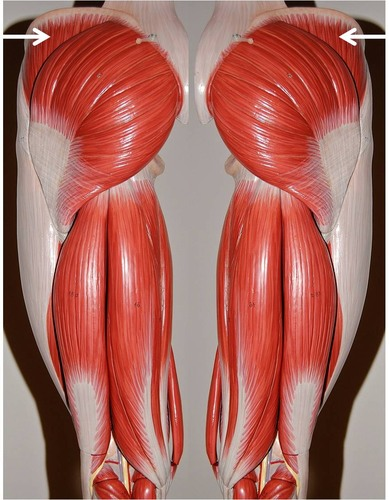 <p>What muscle is this?</p>