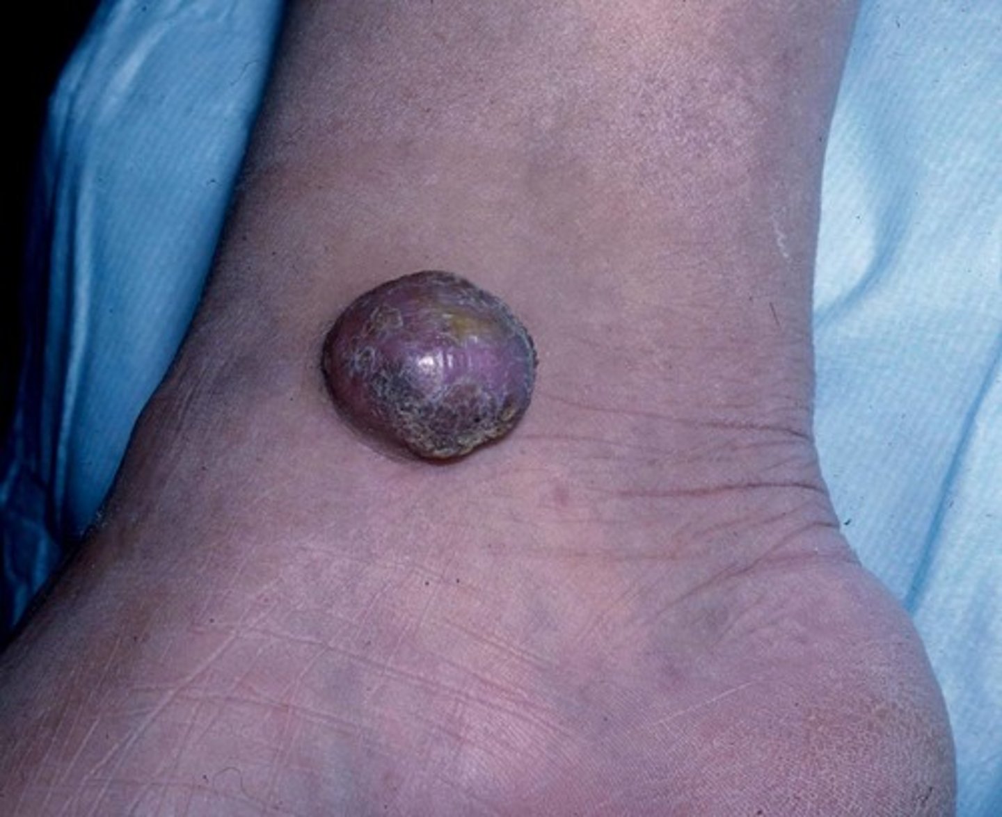 <p>A mass of abnormal cells develops when cancerous cells divide and grow uncontrollably.</p>