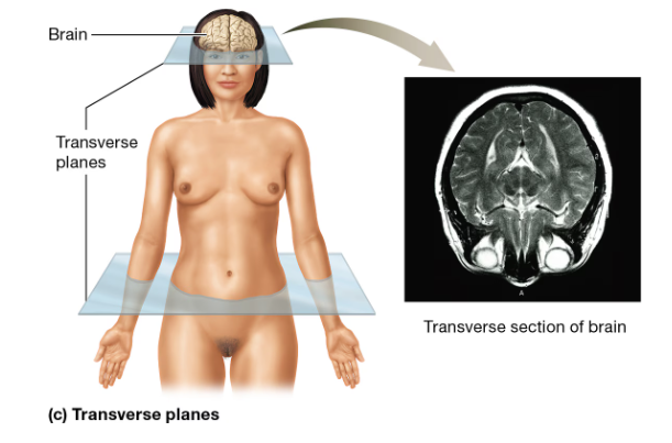 <p>Divides the body/body part into superior and inferior parts.</p><ul><li><p>Divides the appendicular regions into proximal and distal parts.</p></li></ul><p></p>