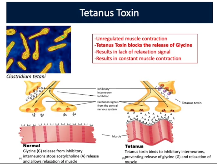<p>Gram Positive, Obligate anaerobe, spore forming, found in soil</p><ul><li><p>Skin is barrier to infection. If barrier perturbed bacterium enters body, produces toxin, causes disease</p></li><li><p><strong>Rusty nail does NOT cause tetanus, </strong>bacterium entering body through puncture causes disease </p></li><li><p><strong>Tetanus Toxin blocks release of Glycine</strong></p></li><li><p>Results in lack of relaxation signal and constant muscle contraction</p></li></ul><p></p>