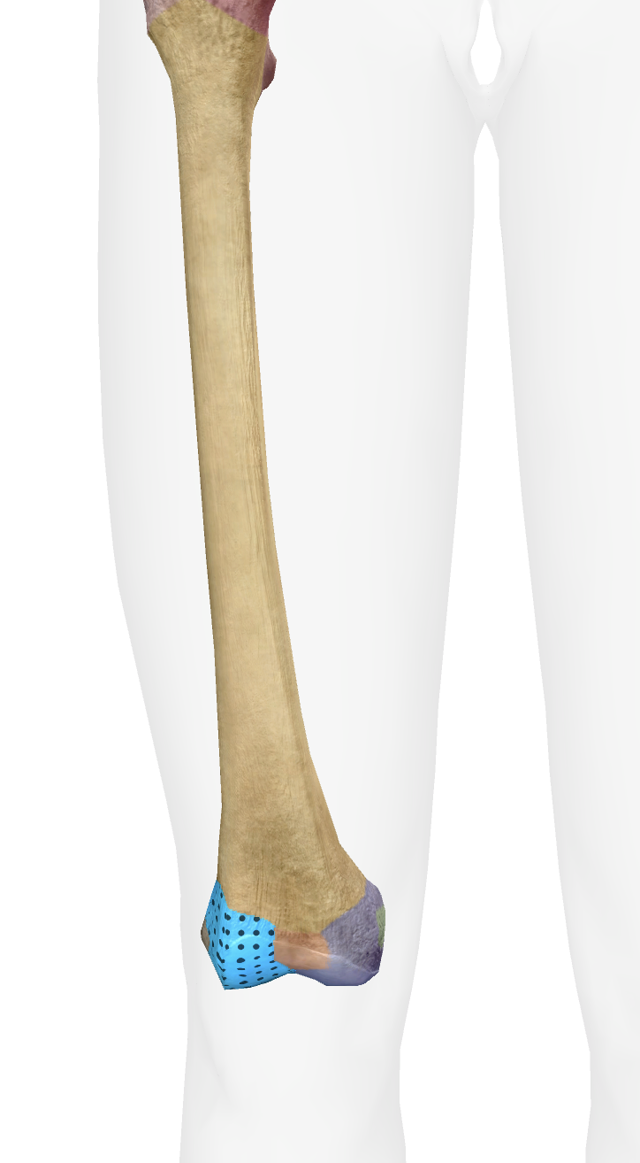 <p>What is this part of the femur </p>