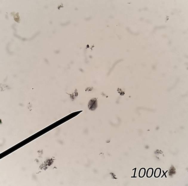 <p>What organism is this, and is it a trophozoite or a cyst?</p>