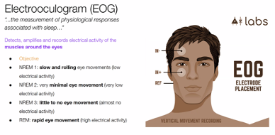 <p><span style="font-family: Aptos, sans-serif;">Detects, amplifies and records electrical activity in muscles responsible for eye movement.&nbsp;Electrodes are attached to the skin above the muscles.&nbsp;Eye movements are a physiological response that can be used to investigate the sleep that is being experienced.&nbsp;REM &amp; NREM is distinguished by eye movement.&nbsp;</span></p>