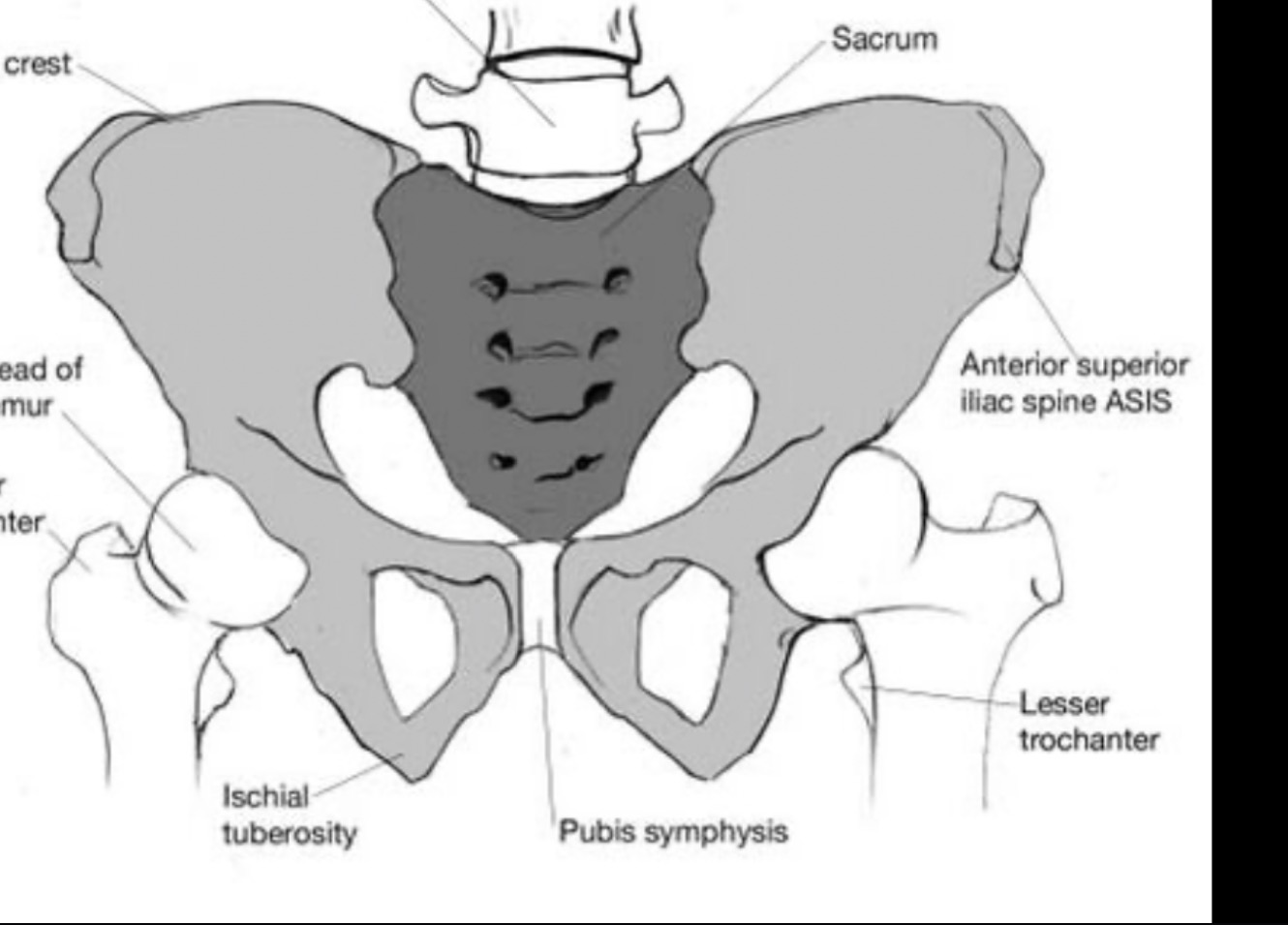 <p>Anterior ridge</p>