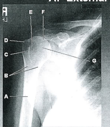 <p>C</p>