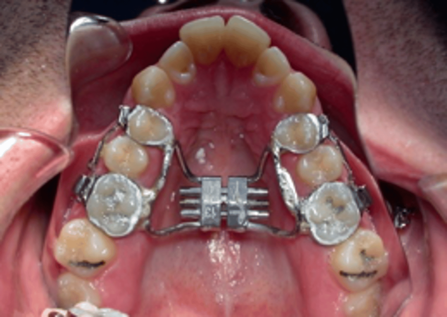<p>ID the appliance:</p>