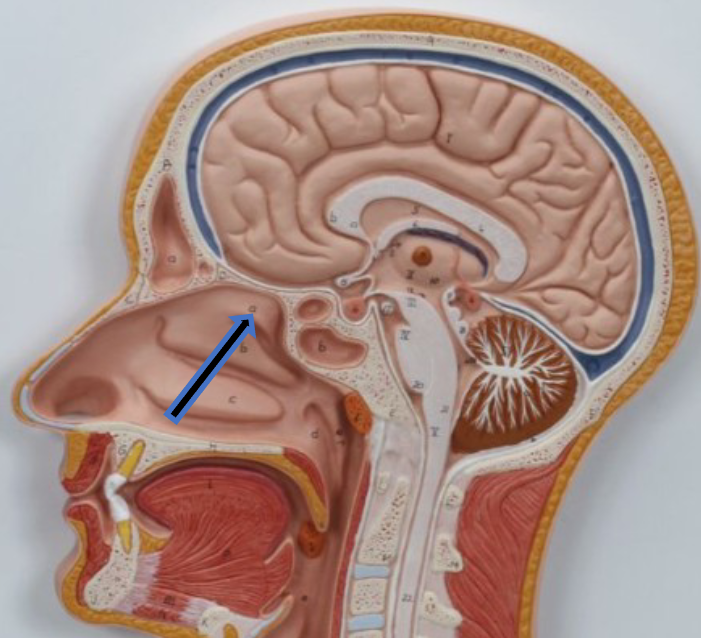 knowt flashcard image