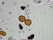 <p>Type of mold? </p>