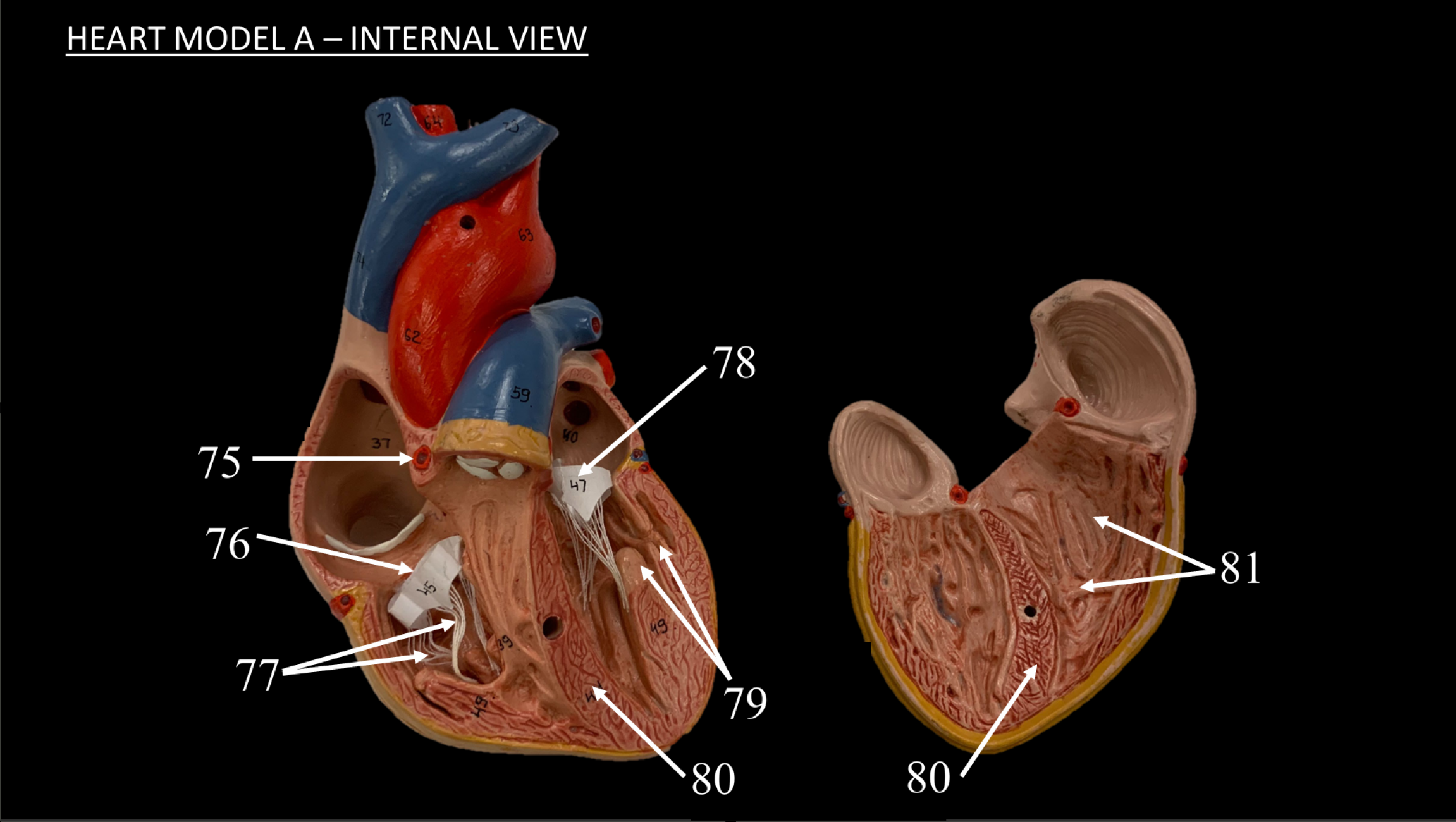 <p>WHAT IS 75 CALLED?</p>