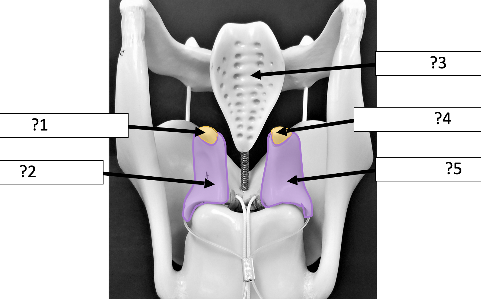 <p>1 Name the structure? </p>