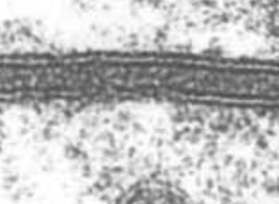 <p>It reveals a distinct "railroad track" or trilaminar (three-layered) appearance. OUTER layer</p>