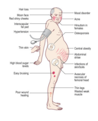 <p>"centrāla" aptaukošanās (sejā un torsā, bet ne ekstremitātēs), osteoporoze, ekstremitāšu muskulatūras atrofija, hiperglikēmija, hipertensija, abdominālas strijas, nomākta imunitāte, sievietēm hirsutisms, ulcerogēna ietekme, psihiski traucējumi (depresija)</p>