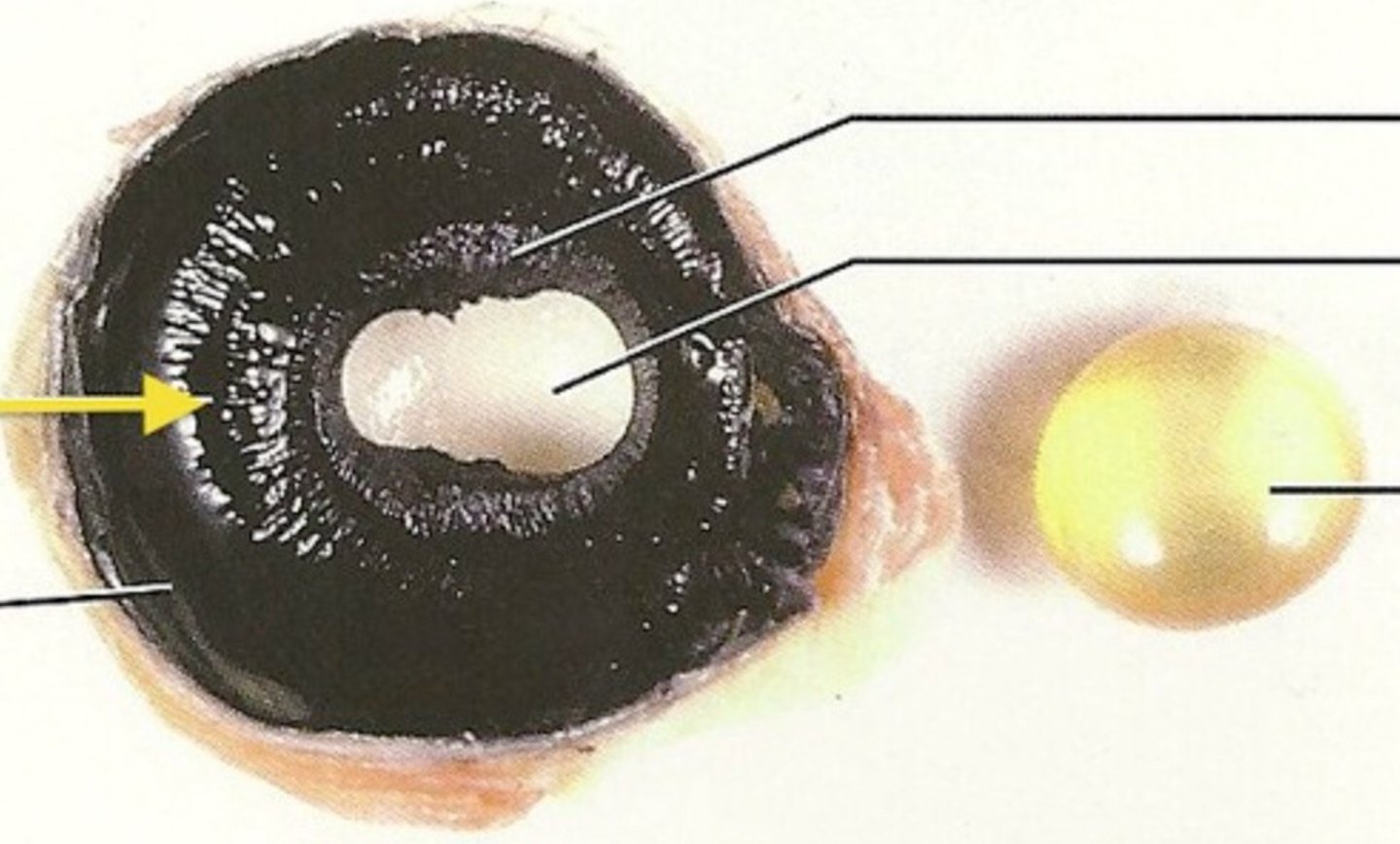 <p>ring of tissue around iris</p>