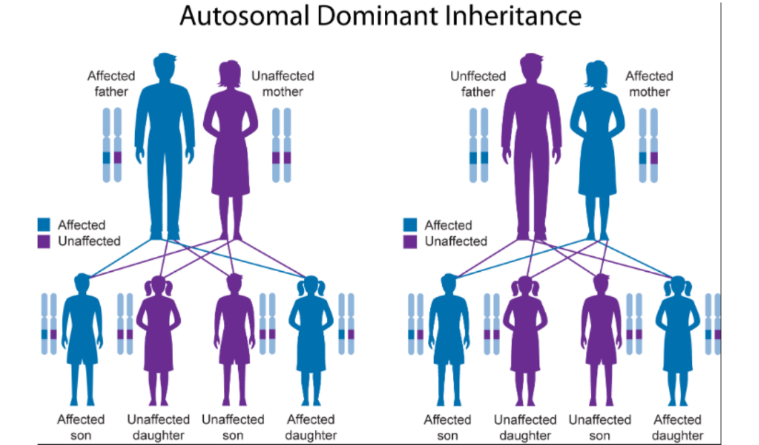 <p>HCM is associated with an <strong>autosomal dominant trait</strong>.</p><p>An individual will only need to get an abnormal gene from ONE parent to inherit the disease. 50% chance</p><p>(Both males & females are affected at the same Rate)</p>