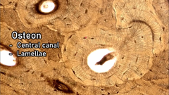 <p>space (white part); tissue type</p>