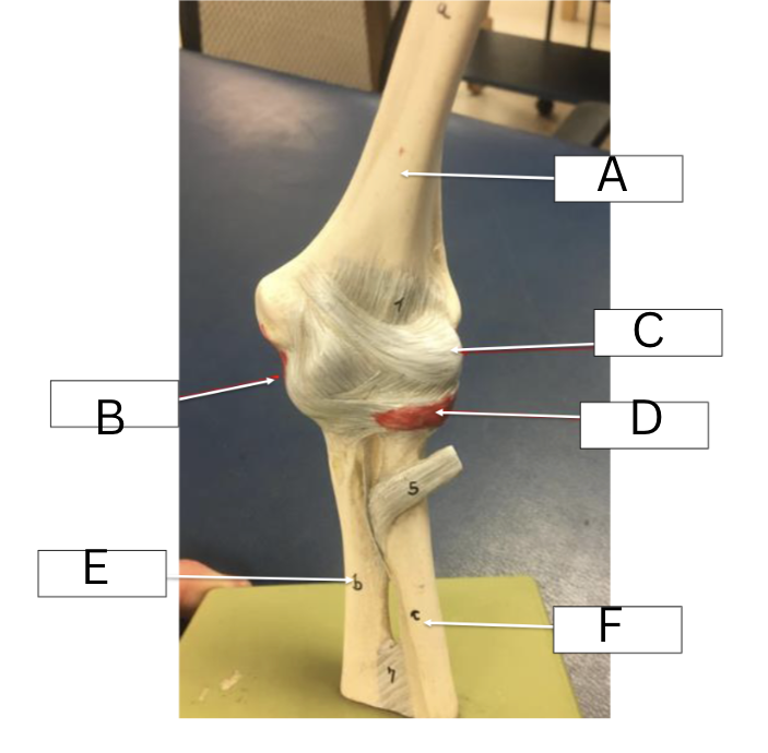 <p><span>Label the elbow ligaments</span></p>