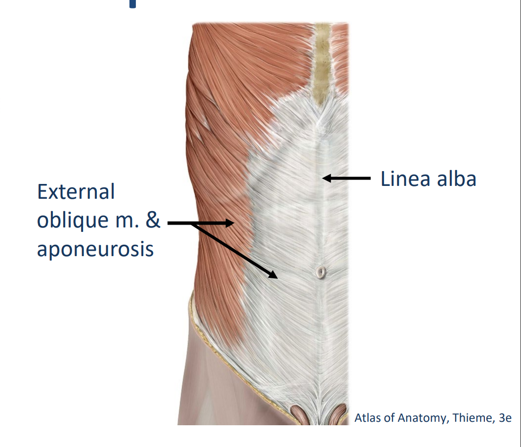 <p>Origin: Ribs</p><p>Insertion: <span style="color: rgb(247, 175, 7);">Linea alba</span>, <span style="color: yellow;"><strong>pubic and ilium of pelvis</strong></span> </p><ul><li><p>Innervation: Intercostal nn. (ventral rami) & subcostal n. (T12 ventral ramus)</p></li></ul><p>.</p><p>Actions:</p><ul><li><p>Bilateral: flex trunk, compress and support abdominal viscera & stabilize pelvis</p></li><li><p>Unilateral: i<span style="color: rgb(13, 233, 249);"><strong>psilateral lateral flexion </strong></span>& <span style="color: yellow;"><strong>contralateral rotation of trunk</strong></span></p></li></ul><p></p>