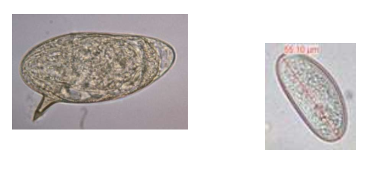 <p>can be schistoma or enterobius</p>