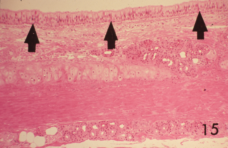 <p><span>Pseudostratified columnar epithelium</span></p>