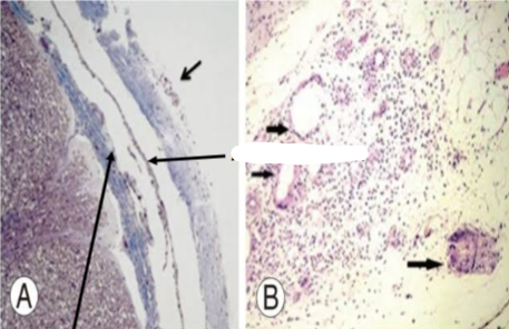 <p>Slide 35</p>