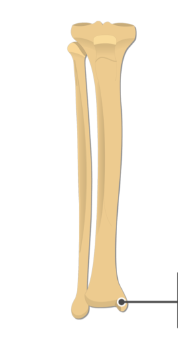 <p>What is this pointing to? What bone is it on?</p>