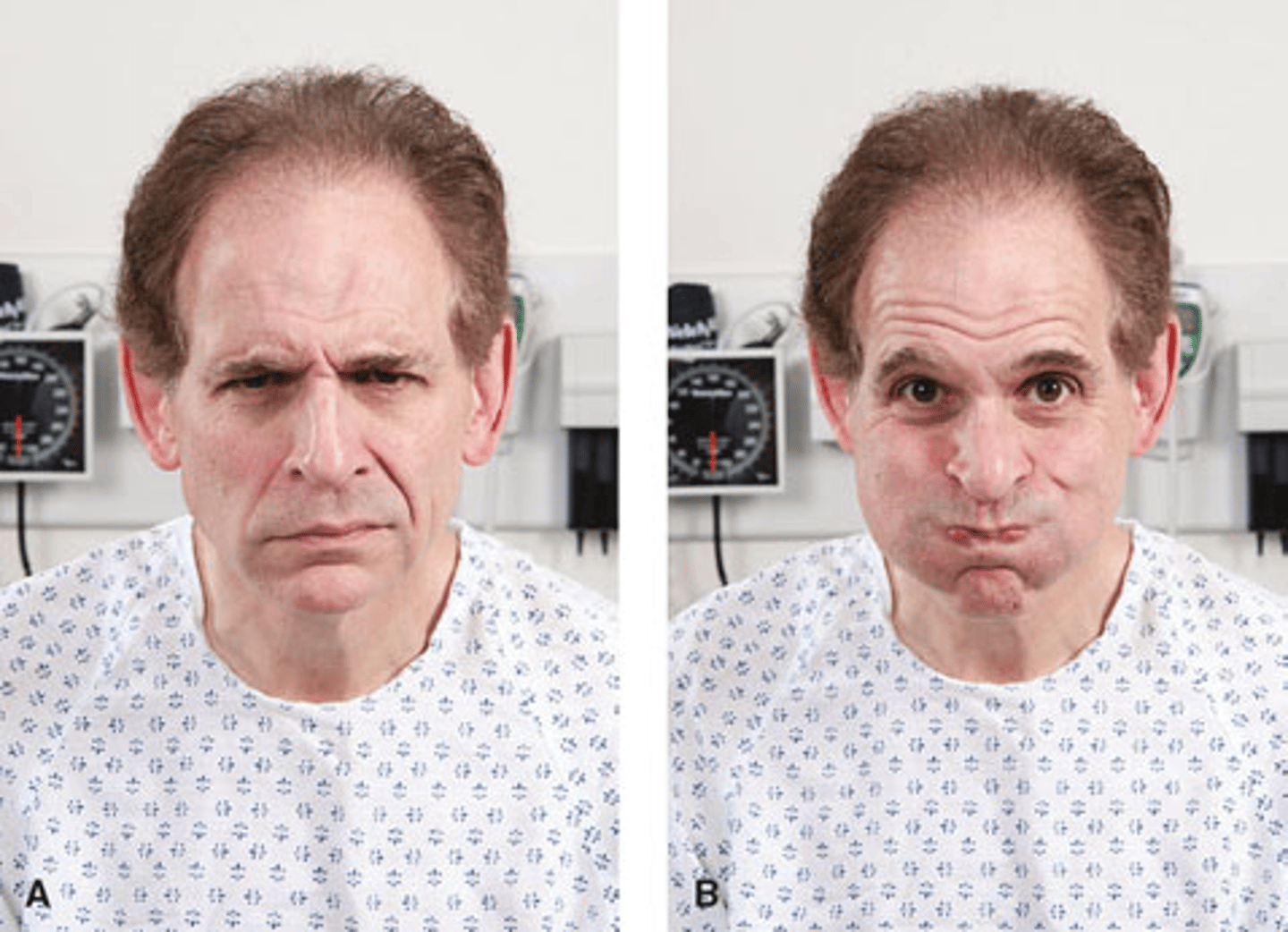 <p>facial nerve (M)</p><p>make different facial expressions</p>